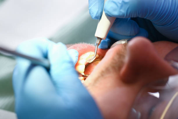 Best Emergency Treatment for Toothache in Lebanon, VA