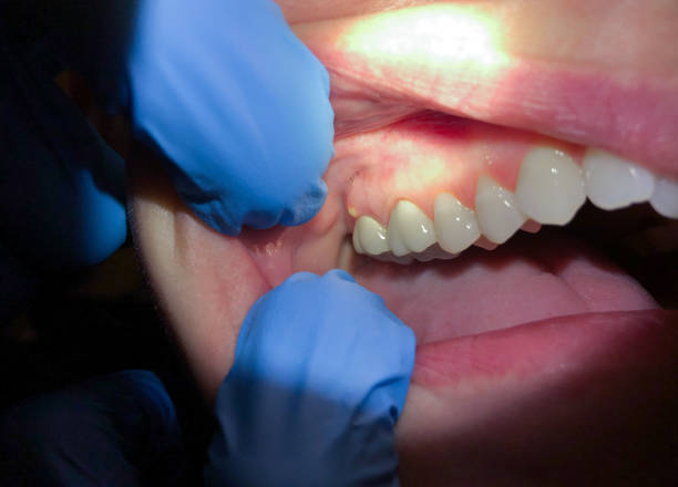 Best After-Hours Emergency Dentist in Lebanon, VA